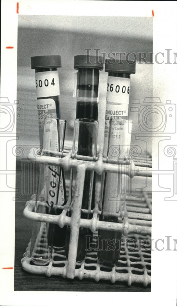 1981 Press Photo Blood in test tubes for testing at United  Community Center - Historic Images