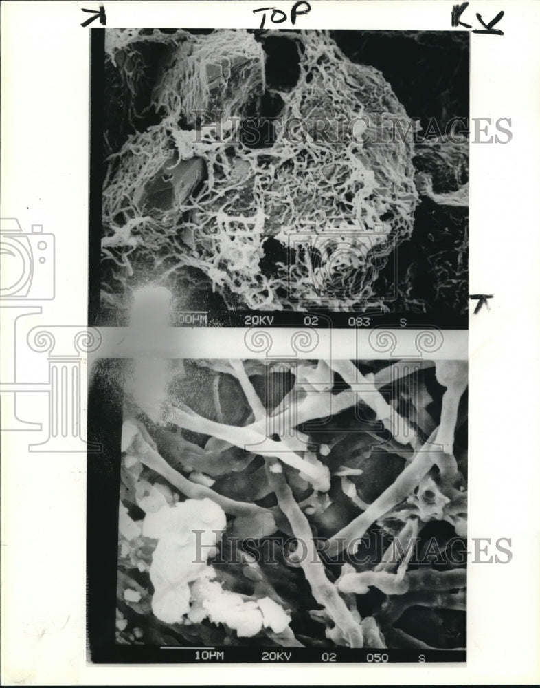 1984 Press Photo Magnification by 100, Lichen capable of living in a rock&#39;s pore - Historic Images