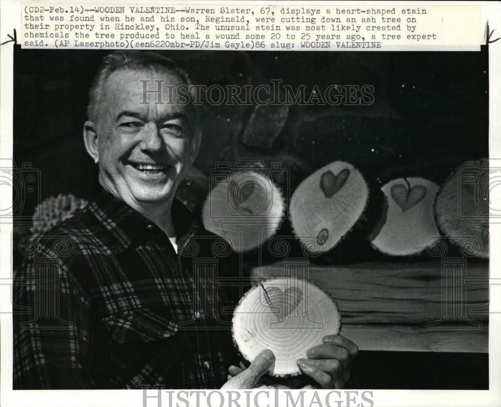 1986 Press Photo Warren Slater Displays a Heart-shaped Stain - cvb13291 - Historic Images