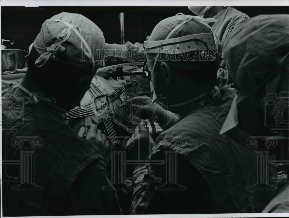 1968, Heart Surgery - cvb21708 - Historic Images