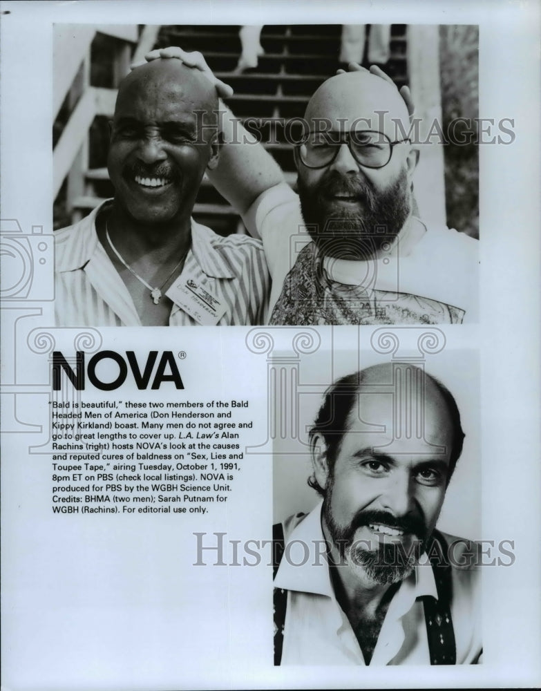 Press Photo Bald Headed Men of America (Don Henderson and Kippy Kirkland) - Historic Images