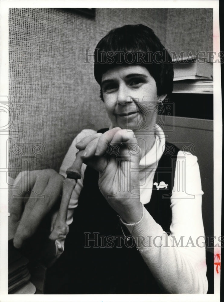 1980 Press Photo: Mrs. Juan Basista shaving artificial finger she had implanted - Historic Images