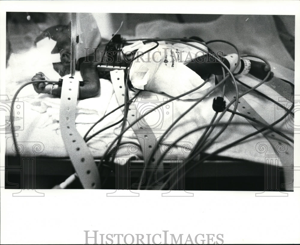 1983 Press Photo Rainbow Babies and Childrens Hosptial Baby Intensive Care Unit - Historic Images