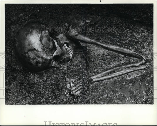 1982 Press Photo This Roman lady & her gem-studded gold rings, 1,900 years ago - Historic Images