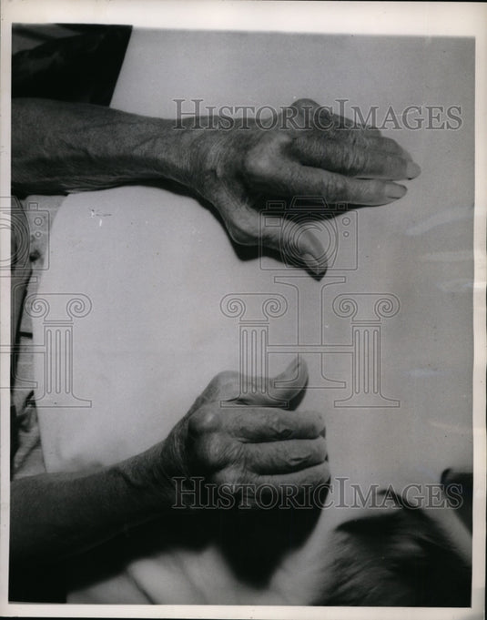1946 Press Photo Here is a pair of hands crippled by Arthritis - cvb37590 - Historic Images