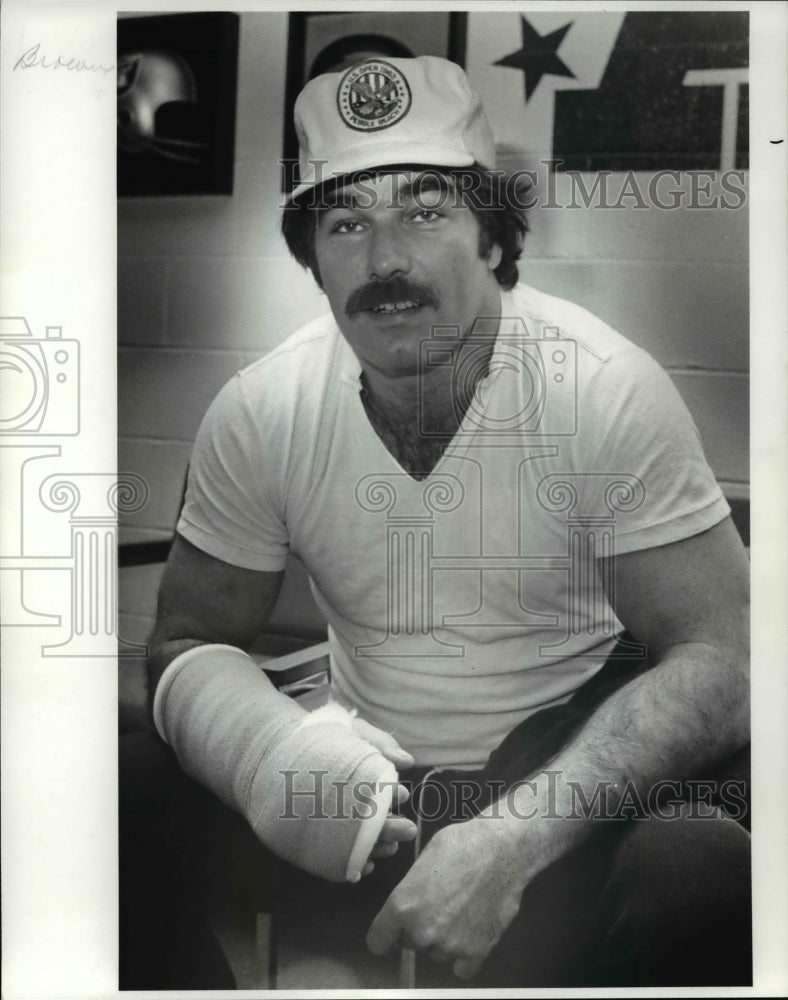 1982 Press Photo Doug Dieken with broken right hand - cvb41194 - Historic Images