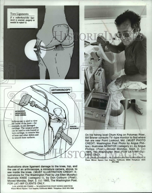1985 Press Photo Ligament damage to the knee illustration - cvb56722 - Historic Images