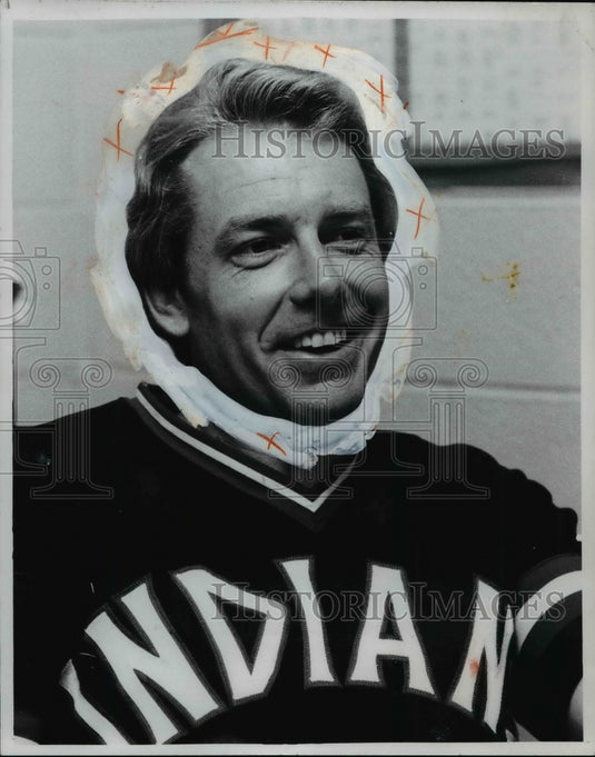 1978 Press Photo Jeff Torborg - cvb64883 - Historic Images