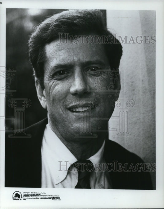 1982 Press Photo Michael Murphy-Historic Images