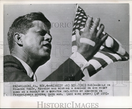 1960 Press Photo Kennedy's scratched hand inflicted by admirers in Pennsylvania - Historic Images