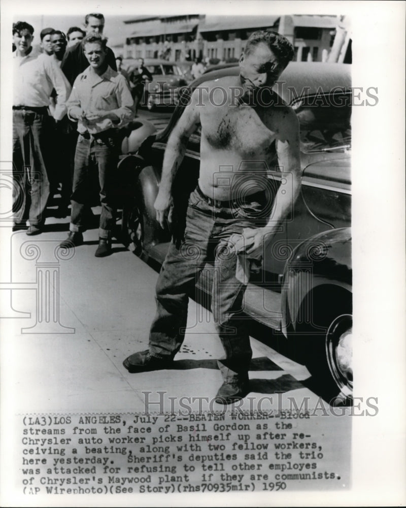 1950 Press Photo Blood streams from the face of Basil Gordon,UAW strike - Historic Images