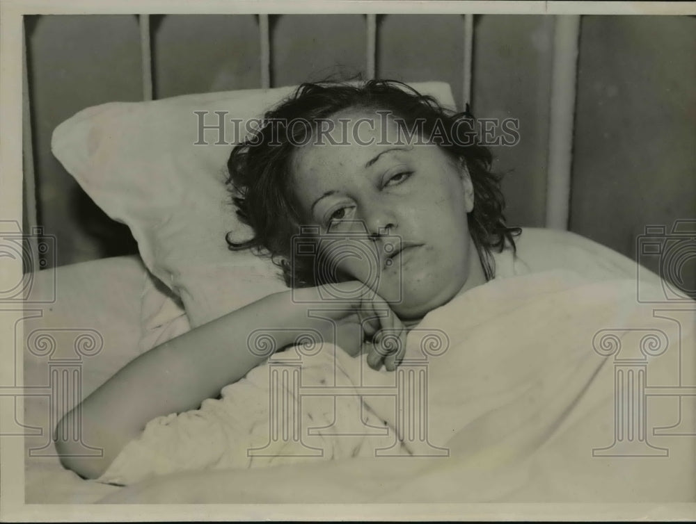 1936 Press Photo Miss Alda Debry, young actress, attacked in Chicago hotel.-Historic Images