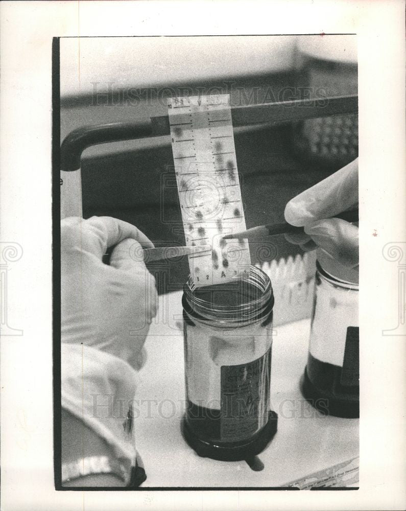 1988 Press Photo Drug test narcotics - Historic Images