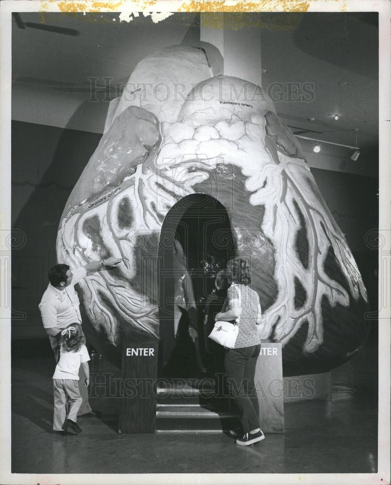 1978 Press Photo Heart Museum Science Industry Chicago - Historic Images