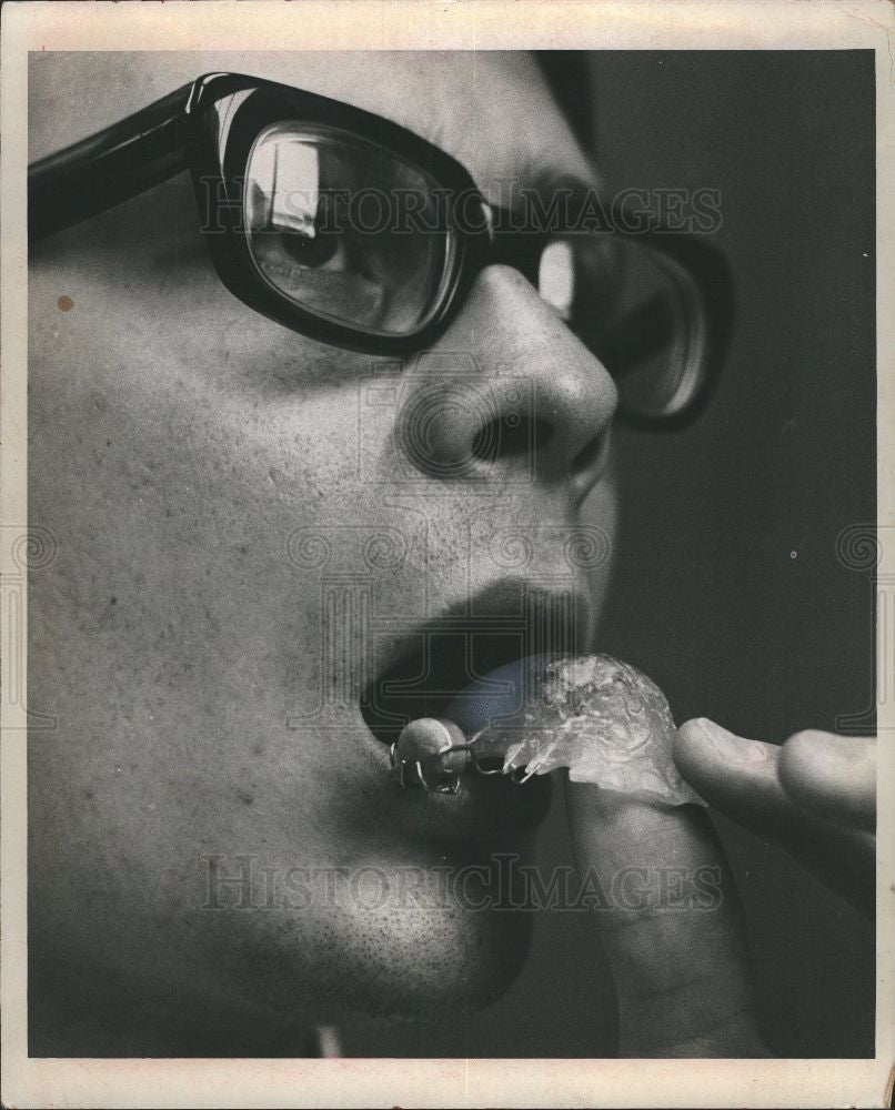 1972 Press Photo hear through teeth Dr. Earl W. Collard - Historic Images