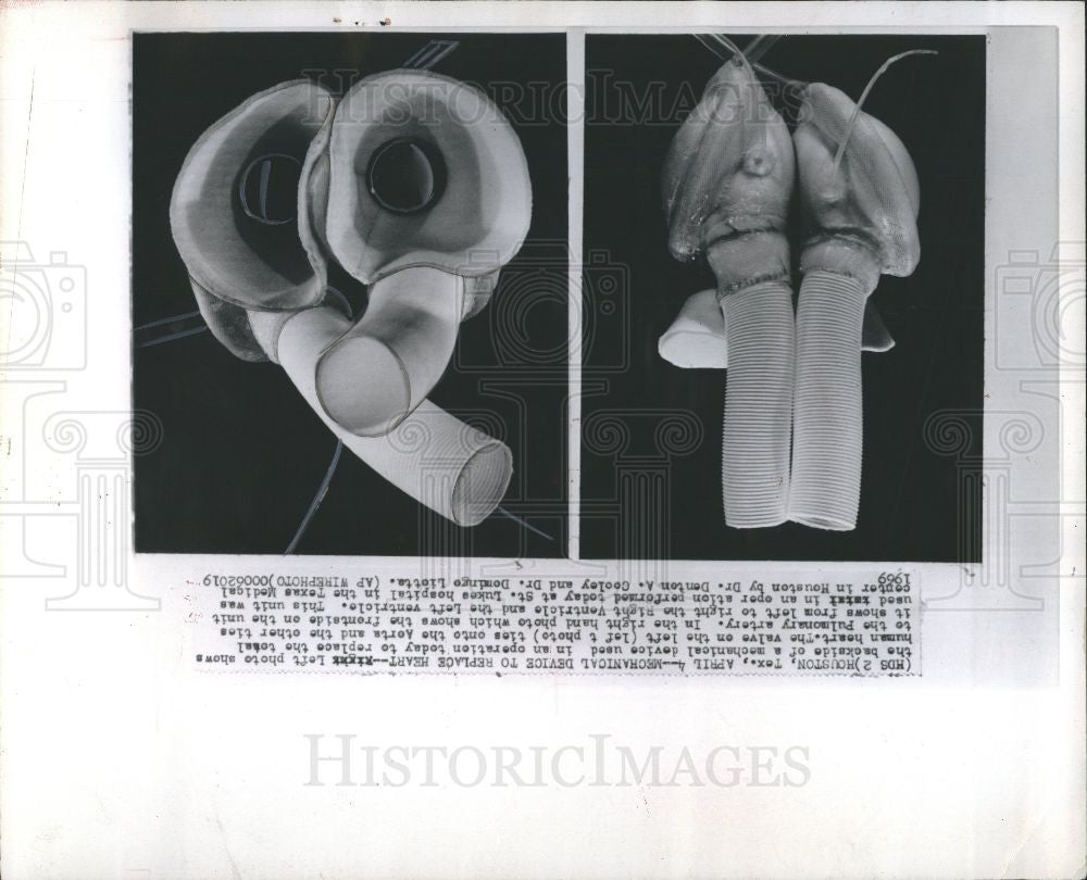 1969 Press Photo heart replacement - Historic Images