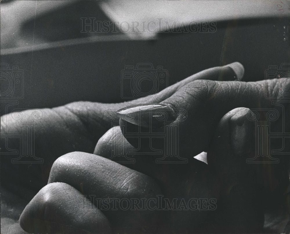 1988 Press Photo Human Hand Finger Fingers Anatomy - Historic Images