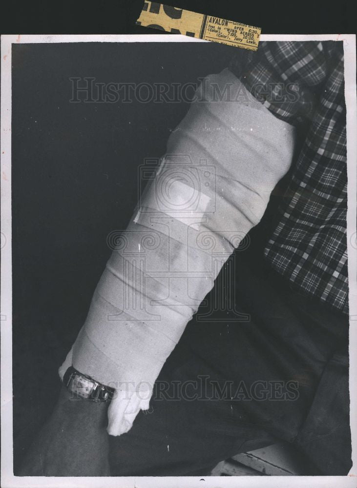1959 Press Photo Fall, Sprained Arm - Historic Images