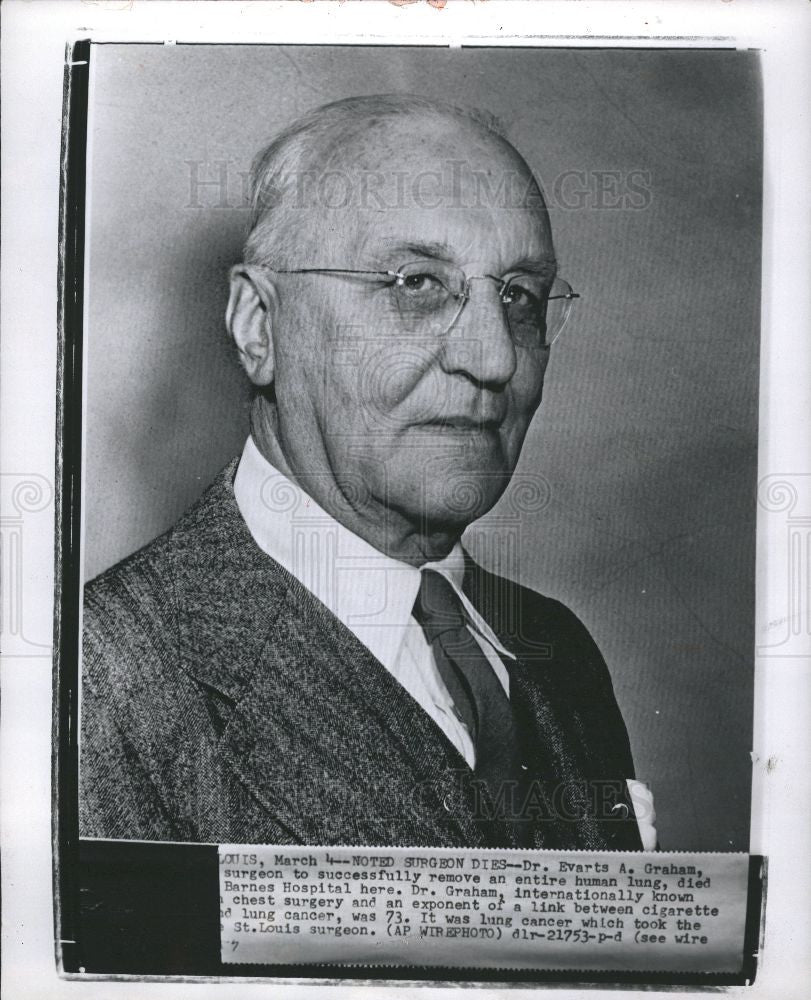 1957 Press Photo Evarts Ambrose Graham  physician - Historic Images