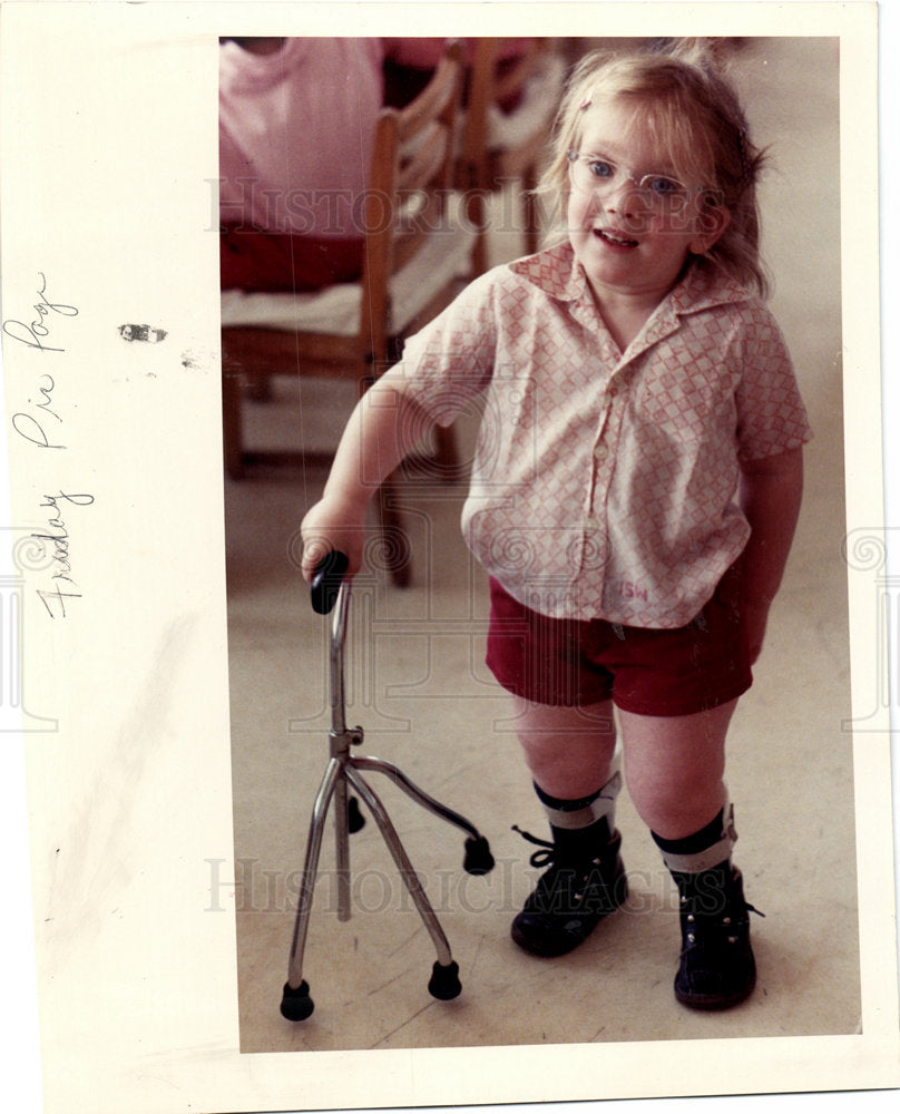 1989 A young patient tries to walk-Historic Images