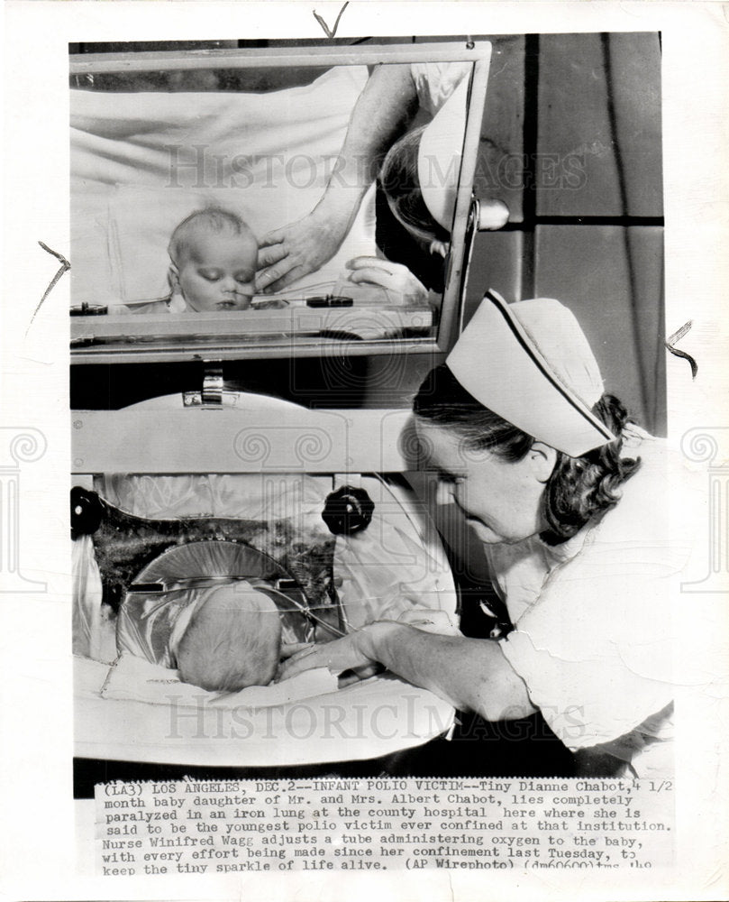 1949 Infant Polio Victim-Historic Images
