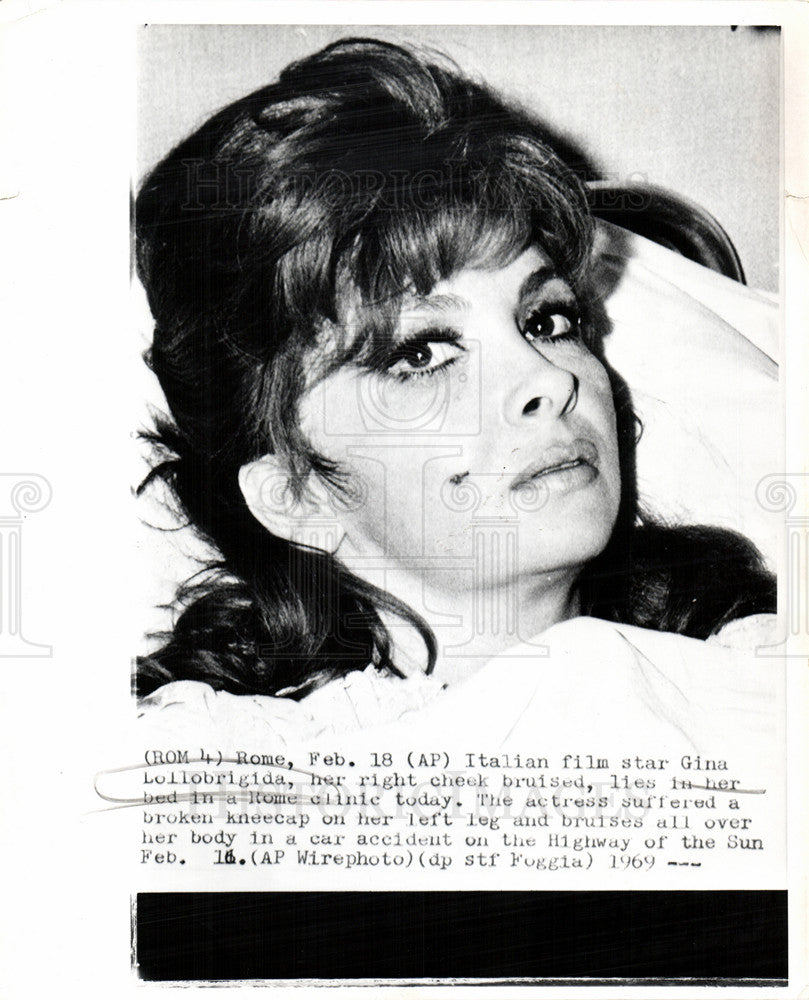 1969 Press Photo Gina Lollobrigida car wreck hospital - Historic Images