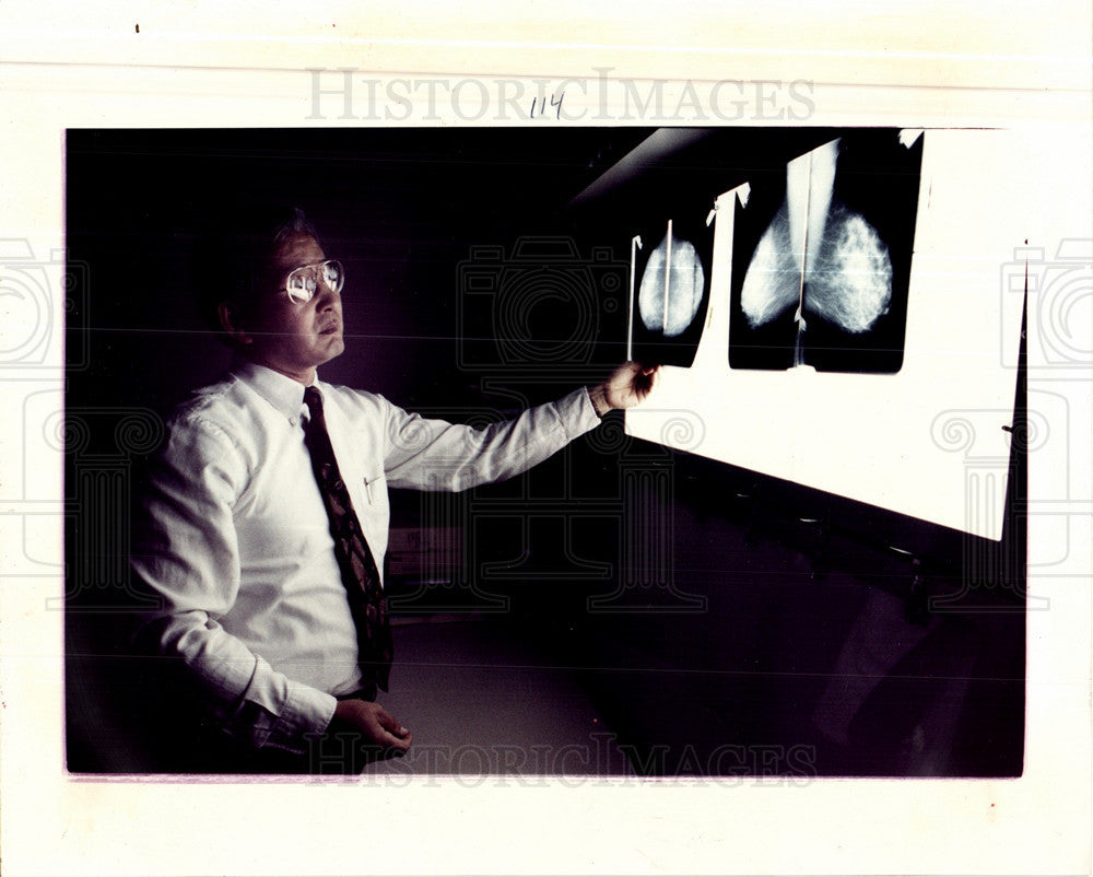 1992 Press Photo mammograms Kyoungsoo Ba Saratoga - Historic Images