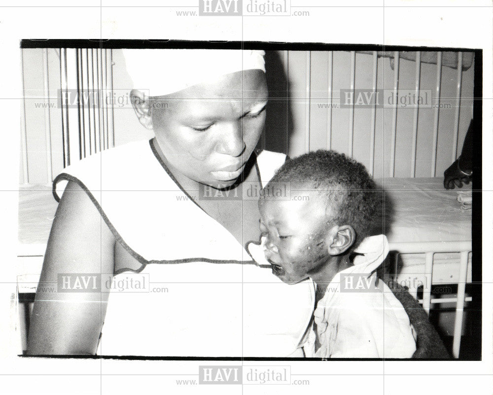 1991 Press Photo South Africa Malnutrition - Historic Images