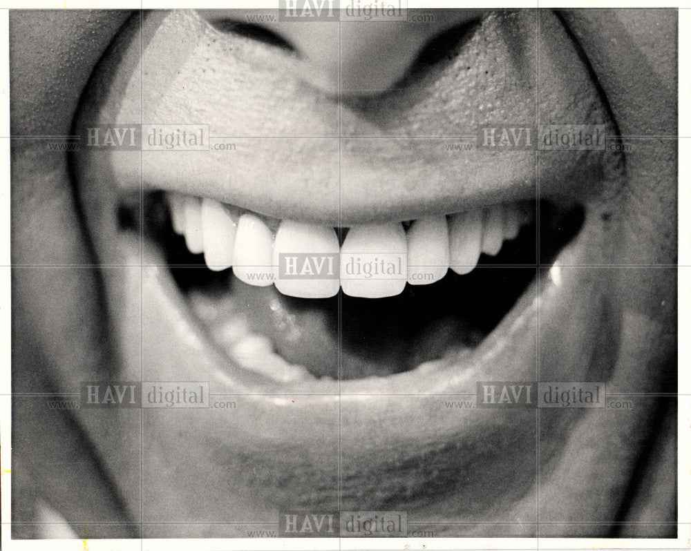 1984 Press Photo Teeth - Historic Images