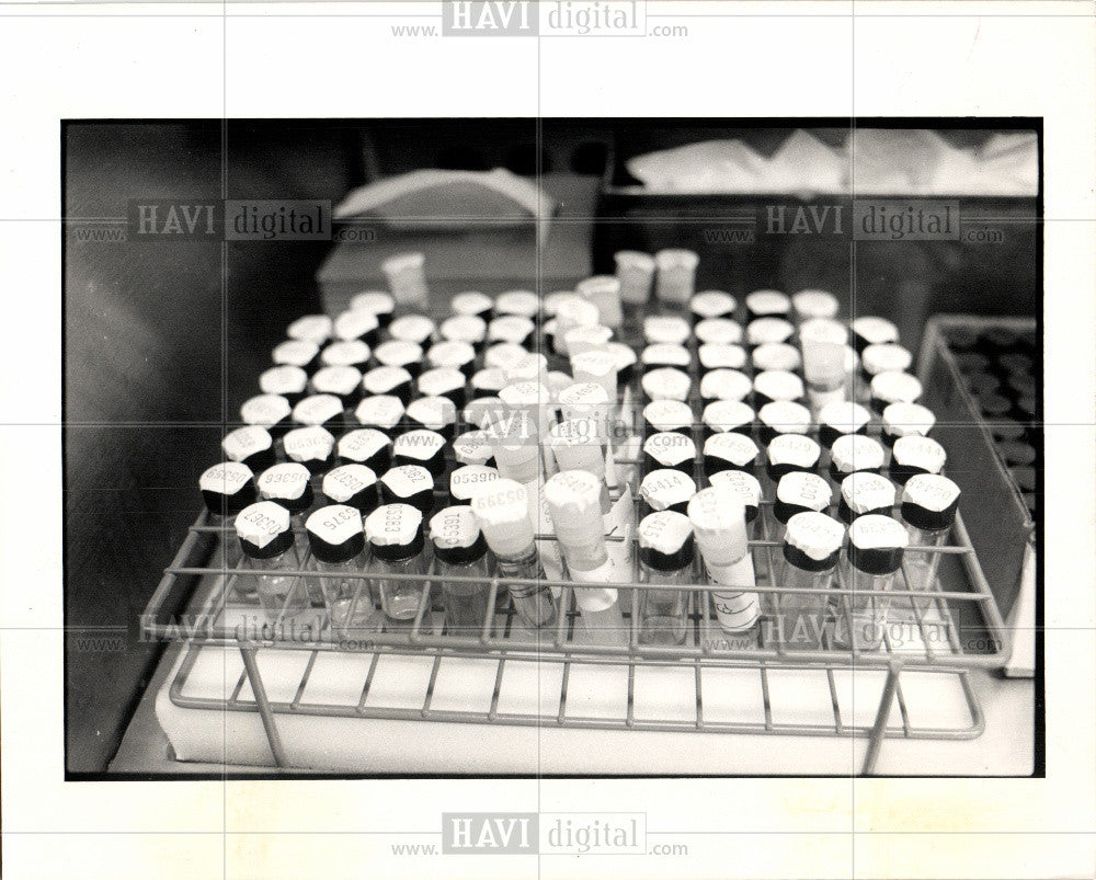 1987 Press Photo AIDS HIV human immune system Michigan - Historic Images