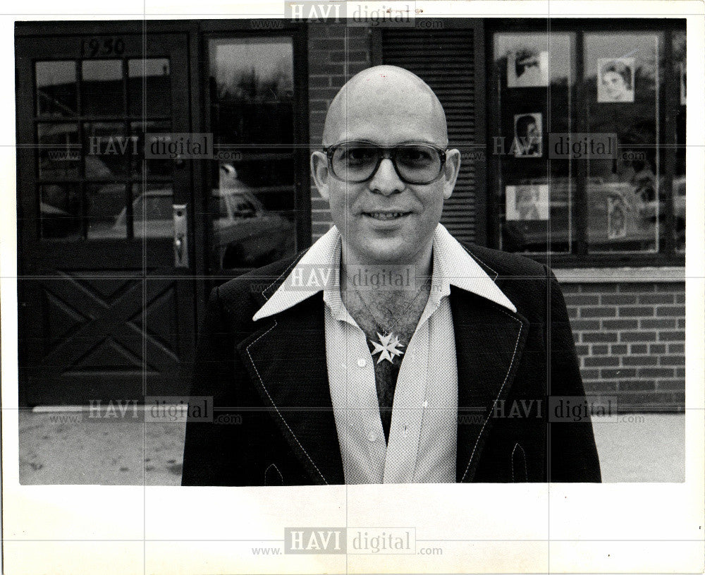 1974 Press Photo Baldness Lack Head Hair - Historic Images