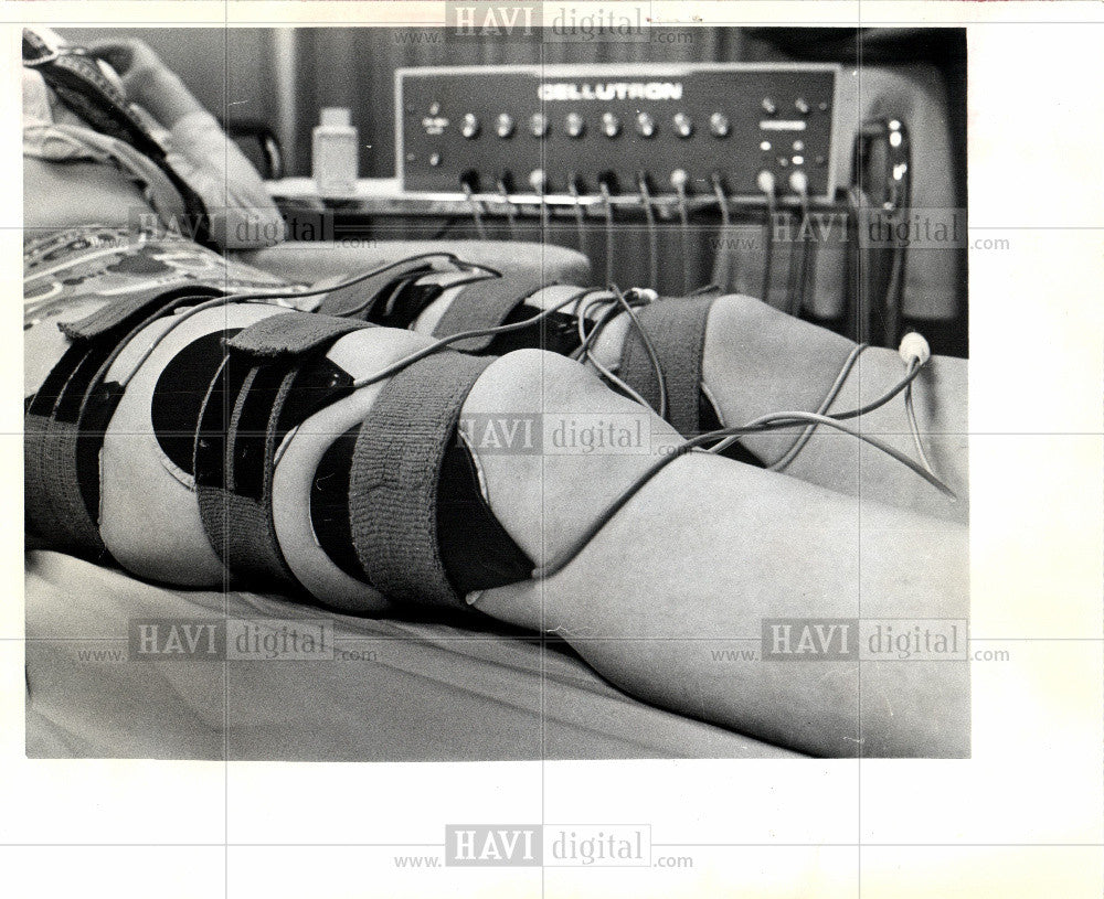 1975 Press Photo Marlene, celltron machine, cellulite - Historic Images