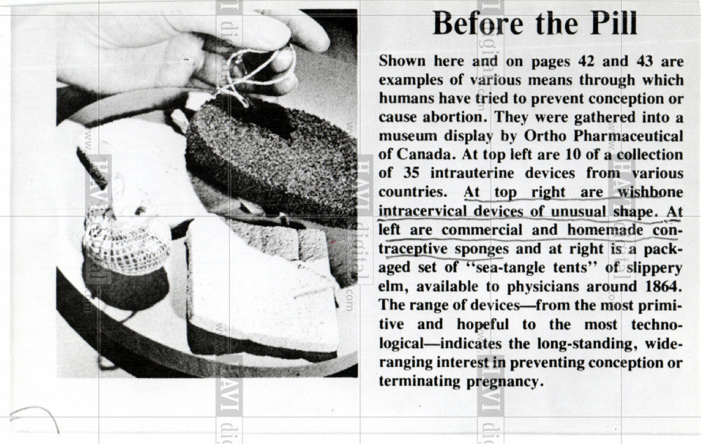 Press Photo prevent conception birth control - Historic Images