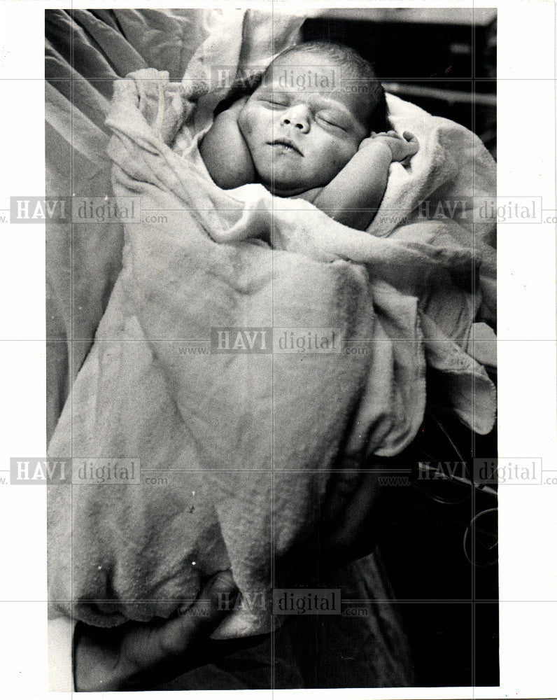 1991 Press Photo baby&#39;s health escaping death - Historic Images