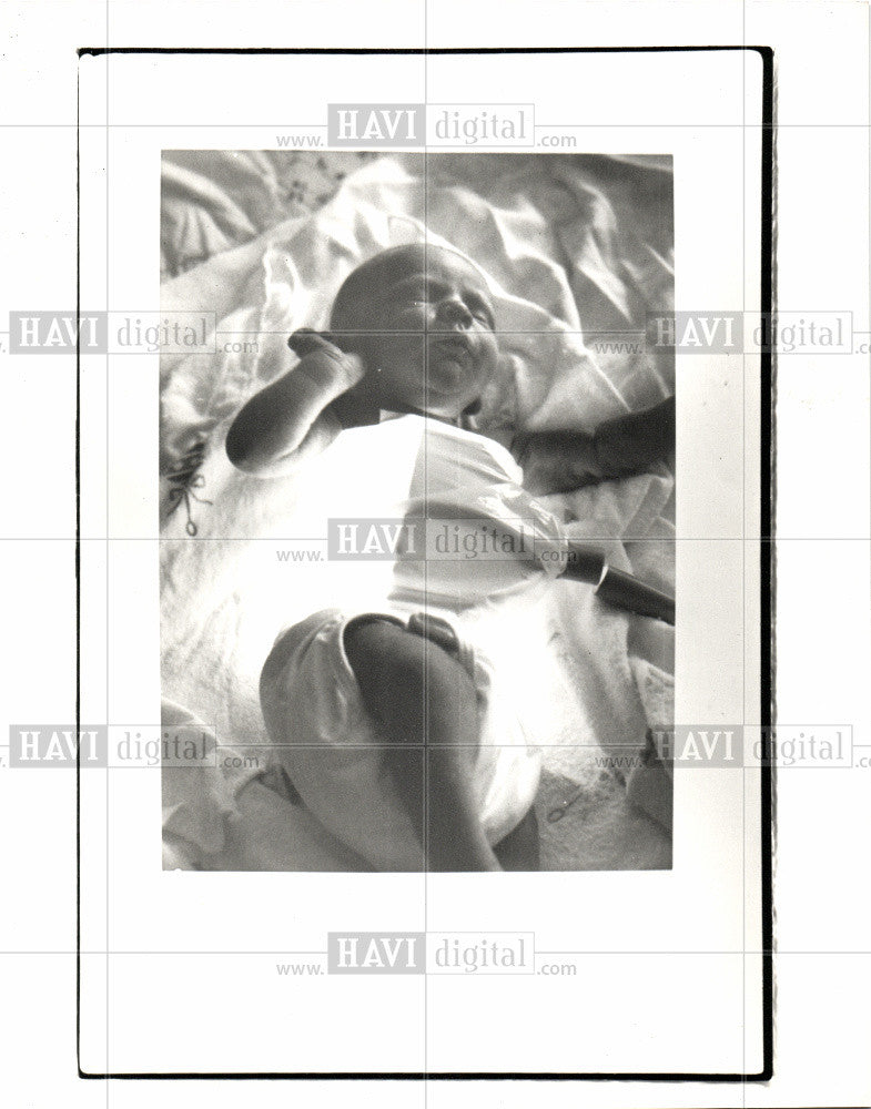 1990 Press Photo fiber-optic blanket jaundice baby - Historic Images