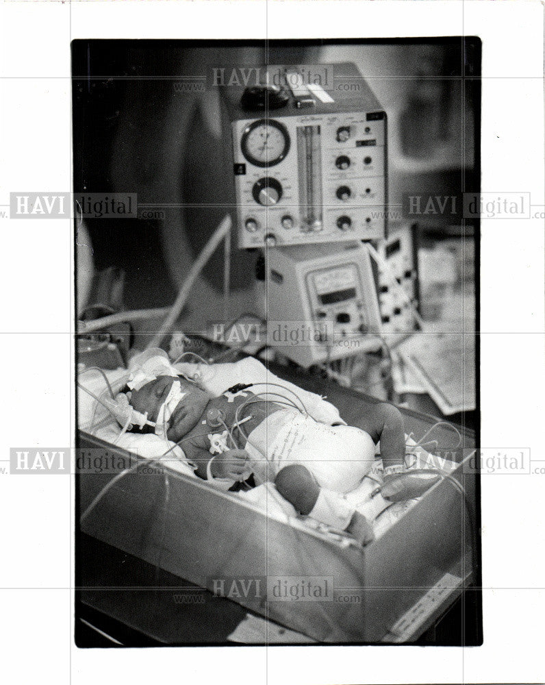 1986 Press Photo Infant Mortality,deaths,causes,complex - Historic Images