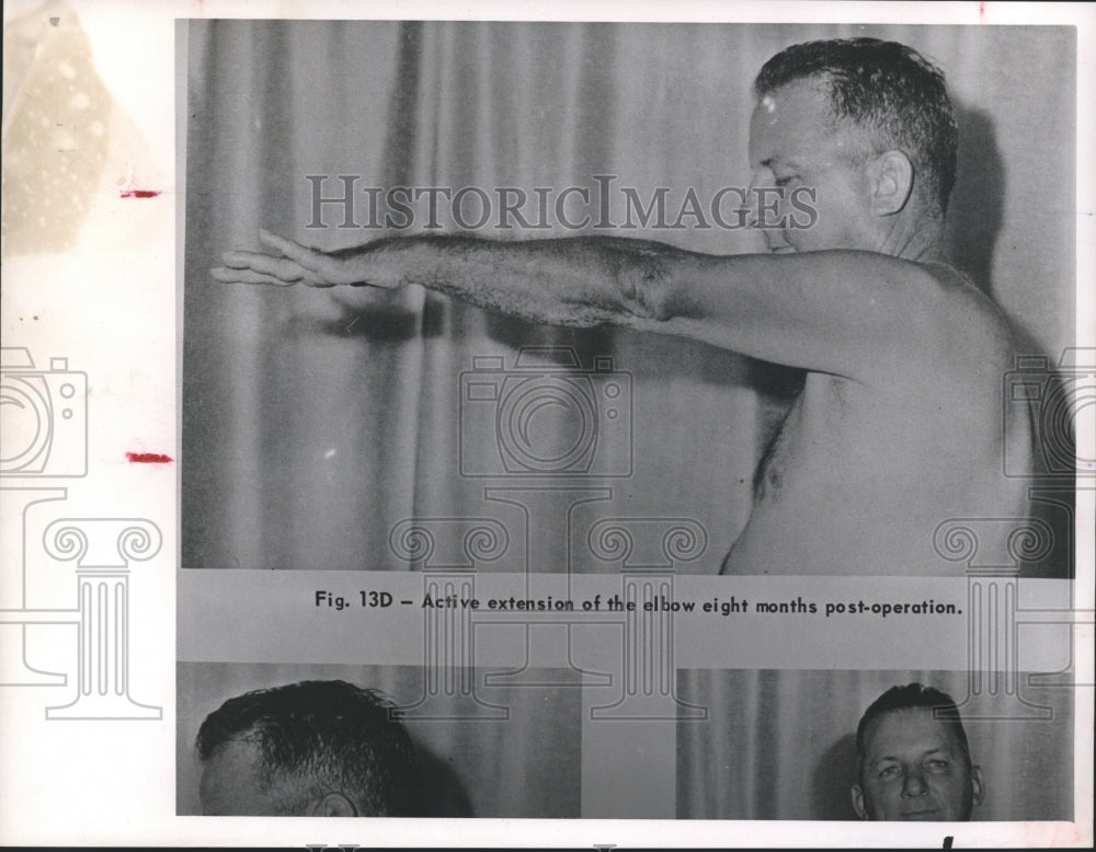 1960 Press Photo Man demonstrates artificial elbow in Houston - hca12958 - Historic Images