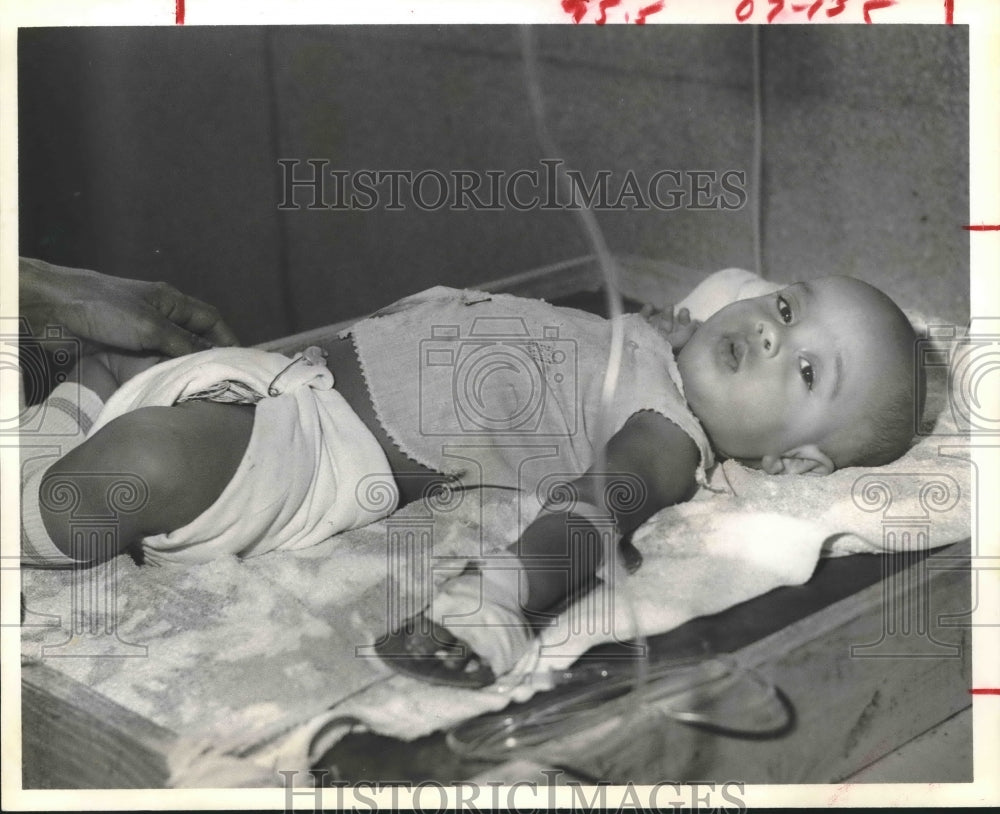 1979 Child in a San Cristobal Hospital In The Dominican Republic. - Historic Images