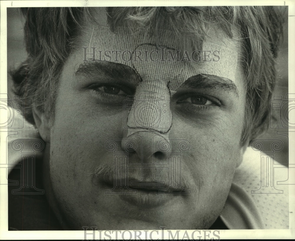 1984 Press Photo Houston offensive tackle Gary Heitmann with nose bandaged.- Historic Images