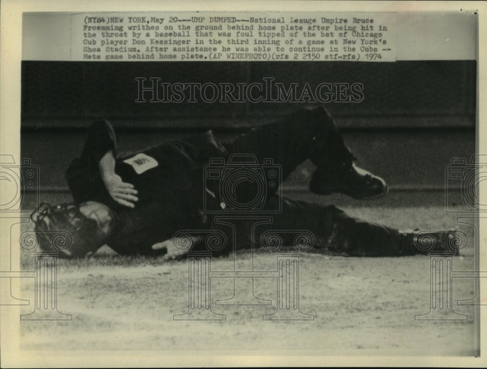 1974 Press Photo Umpire Bruce Froemming injured in game, NY Shea Stadium - Historic Images