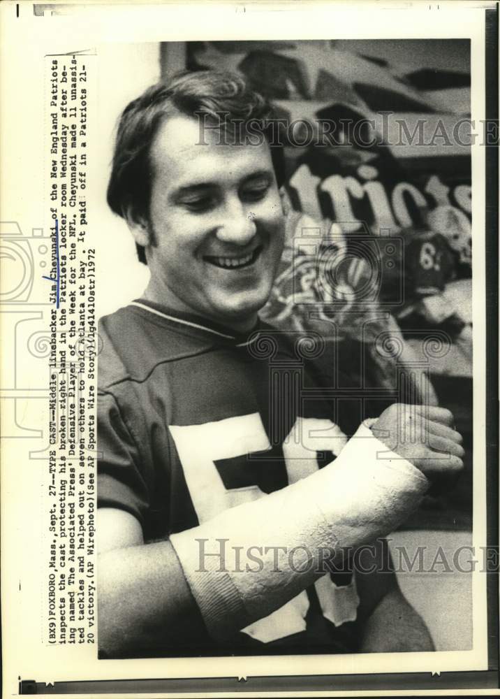 1972 Press Photo Patriots' Linebacker Jim Cheyunski inspects hand cast in MA. - Historic Images