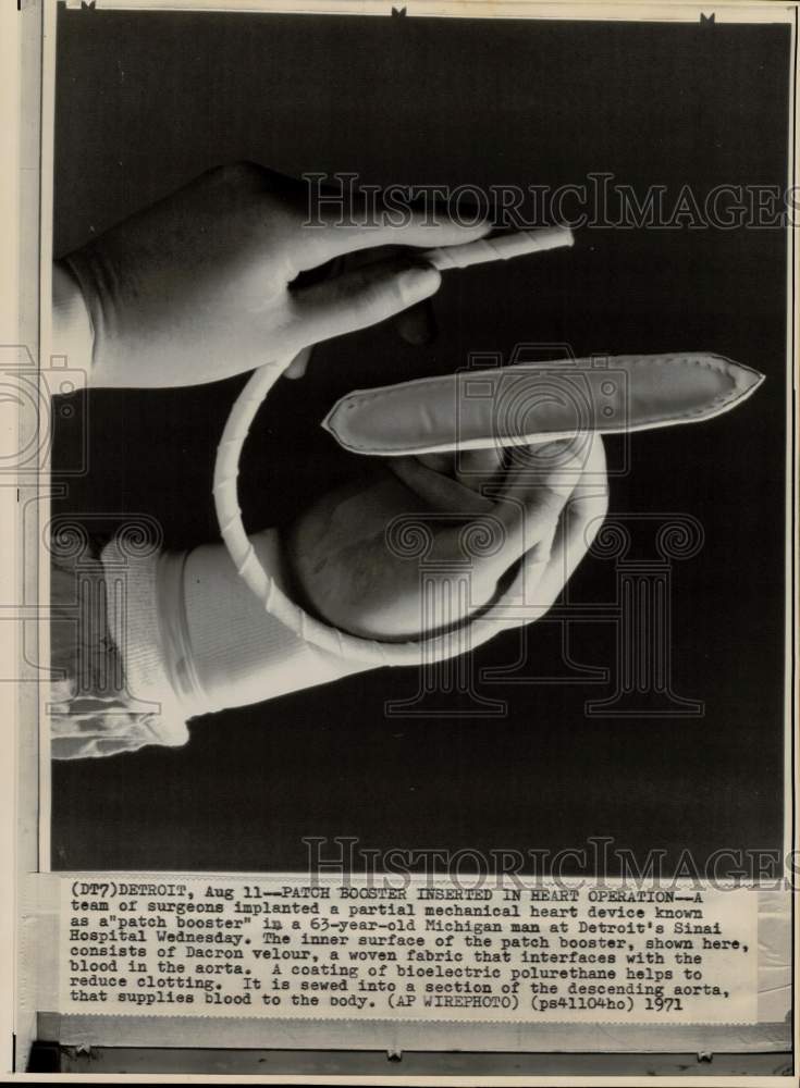 1971 Press Photo Partial mechanical heart device called patch booster in Detroit- Historic Images