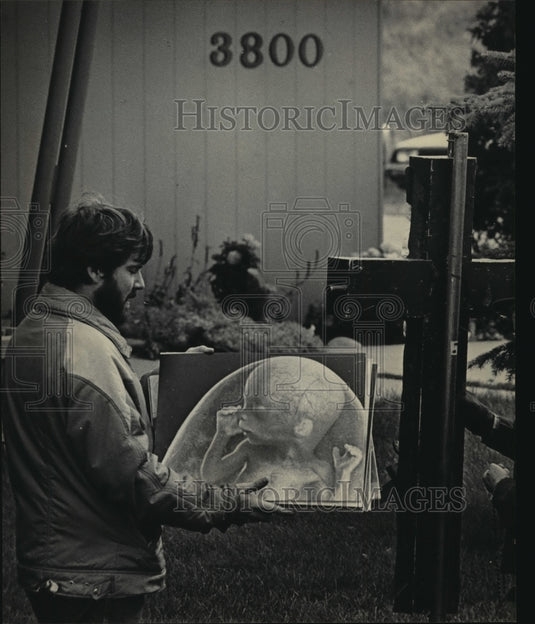 1984 Press Photo At a recent protest, Horn displayed a pictured of a fetus-Historic Images