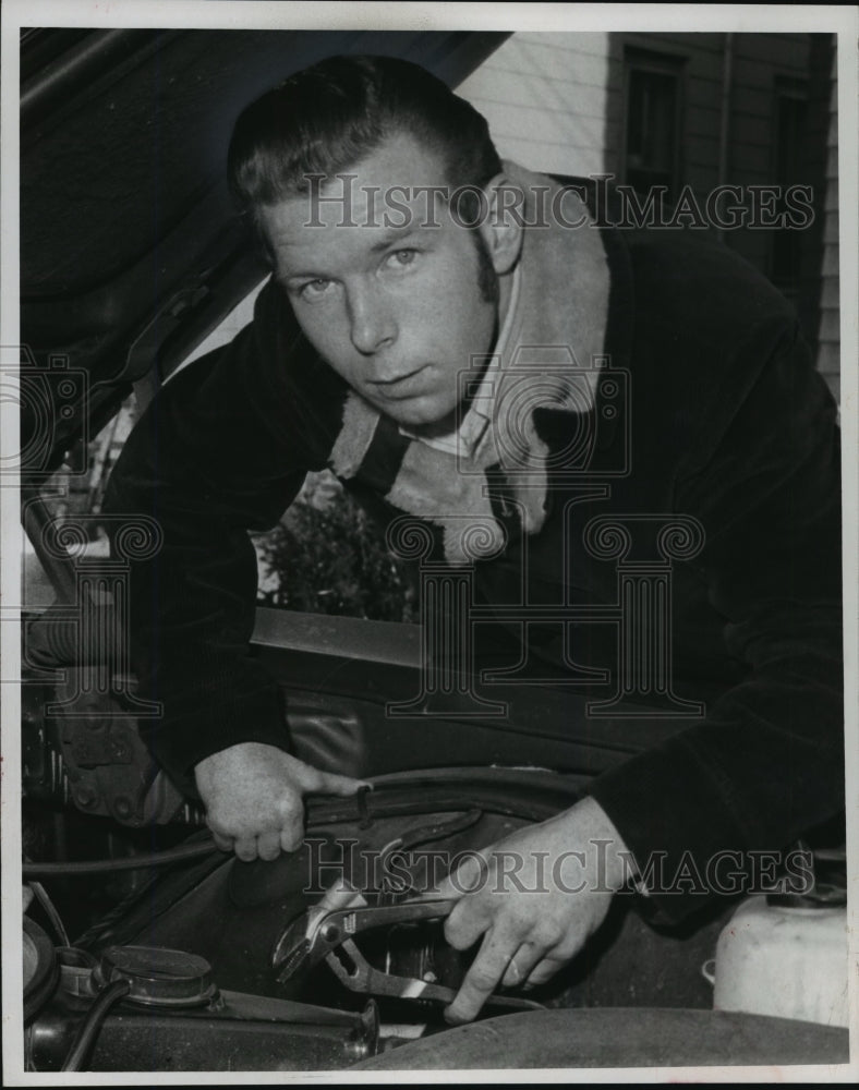 1970 Press Photo Everett Red Knowles 1st person w/ severed limb to be replanted-Historic Images