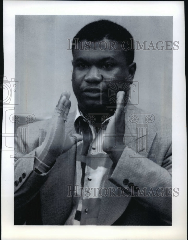 1993 Press Photo Christopher Wilson, a victim of a crime - mja34236-Historic Images