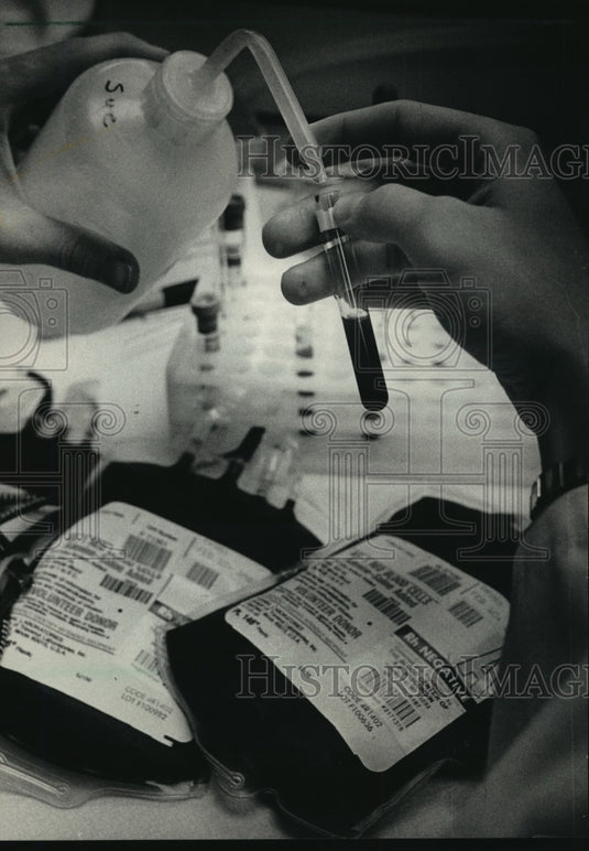 1987 Press Photo The blood center tests & matches the blood it receives-Historic Images