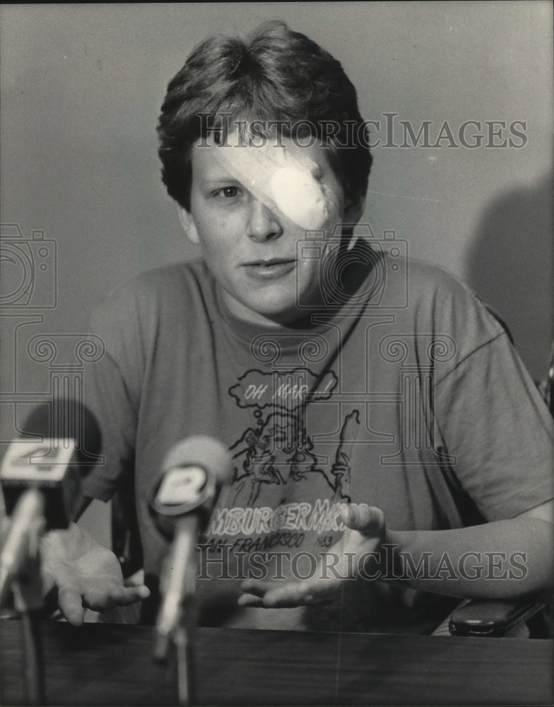 1984 Press Photo Jill E. Binon bombing victim suffered Burns to the face - Historic Images