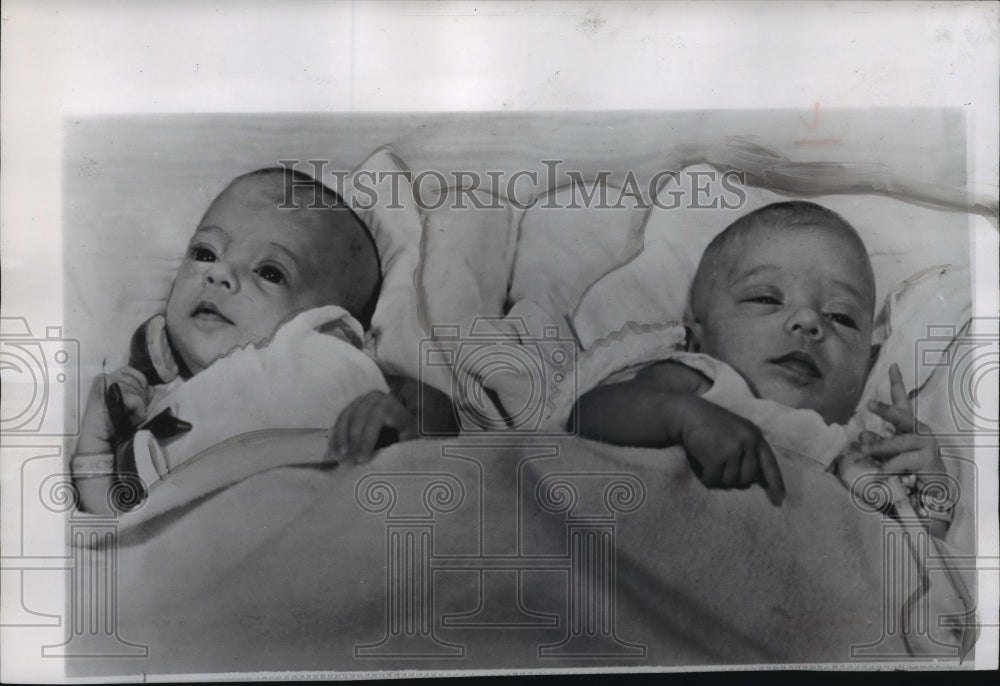 1953 Press Photo Siamese Twin Daughters of Lafayette, La., Mayor Ashton Mouton-Historic Images