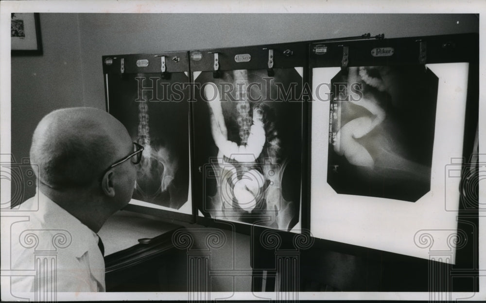 1958 Press Photo Dr. Larson studies X-rays of chest and digestive organs. - Historic Images