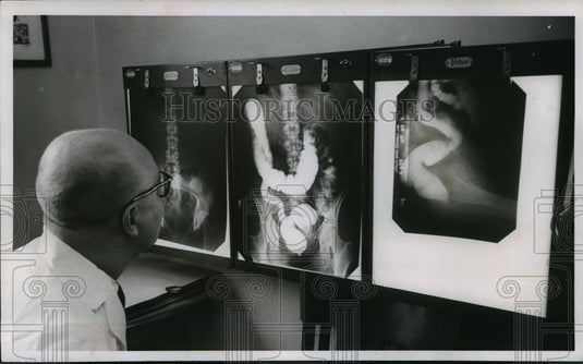 1958 Press Photo Dr. Larson studies X-rays of chest and digestive organs. - Historic Images